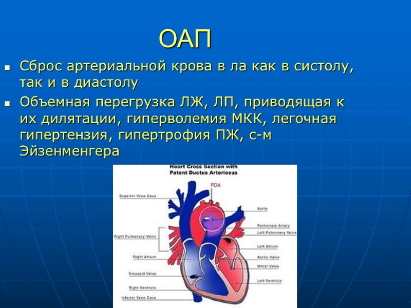 ОАП Сброс артериальной крова в ла как в систолу, так и в диастолу Объемная